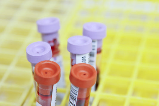 Vacuum Blood Collection Tubes and Their Benefits You Need To know